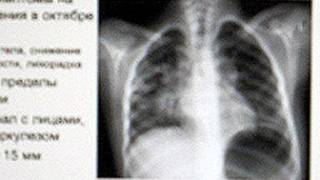 Шуши афроди бемори сил