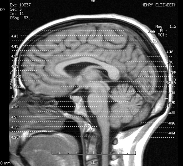 my brains - let me show you them by Liz Henry