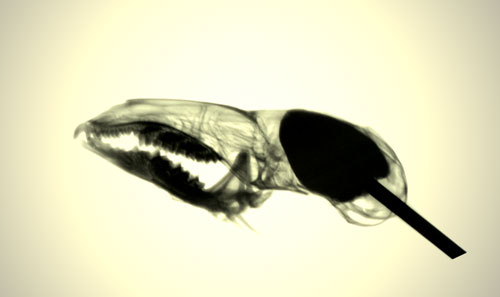 x-ray question three